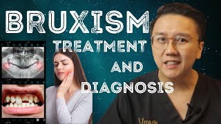 Teeth Grinding when sleeping Bruxism  Symptoms Treatment amp Diagnosis [upl. by Hairym]