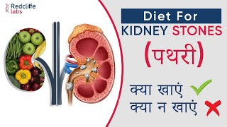 ✅ Diet for Kidney stones in Hindi  किडनी स्टोन में भूल से भी नहीं खाएं ये चीजें  Kidney Stone Diet [upl. by Sosanna142]