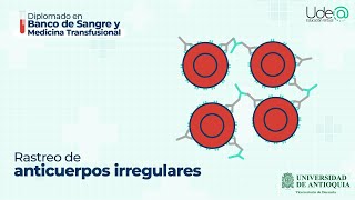 Rastreo de anticuerpos irregulares [upl. by Ahsial]