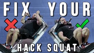 9 Hack Squat Mistakes and How to Fix Them [upl. by Del]