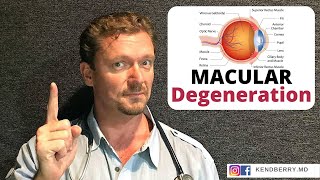 Macular Degeneration  What To Do To Save Your Sight [upl. by Yona]