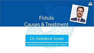 What is Fistula  Symptoms amp Treatment of Fistula [upl. by Assila]