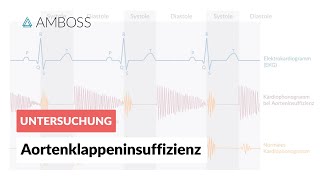 Aortenklappeninsuffizienz  Herzgeräusch  AMBOSS Video [upl. by Anthiathia76]