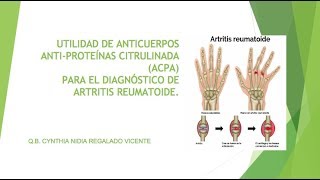 ANTICUERPOS ANTIPROTEÍNAS CITRULINADA [upl. by Collins]