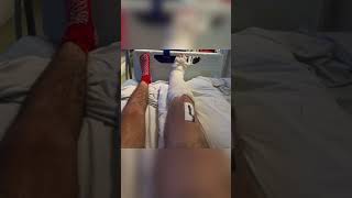 Broken Tibia and Fibula RECOVERY JOURNEY [upl. by Asiar]