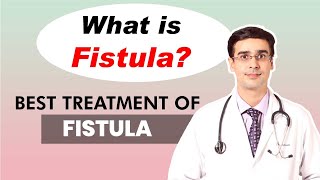 Are home remedies helpful for fistula treatment  Dr Sharad Kulkarni [upl. by Aneleasor861]