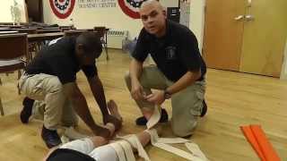 Tibia Fibula splinting [upl. by Josey]