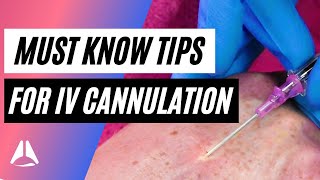 Important tips and tricks for IV cannulation [upl. by Dobson356]