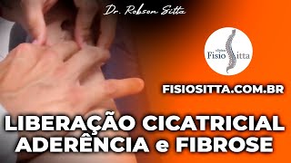 MASSAGEM de LIBERAÇÃO CICATRICIAL PREVENÇÃO ADERÊNCIA FIBROSE Clínica Fisioterapia Dr Robson Sitta [upl. by Sirtaeb318]