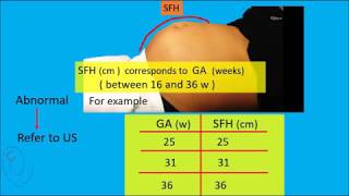 Symphysis Fundal Height  SFH  measurement [upl. by Euqnimod846]