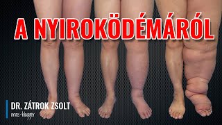 Nyiroködéma 1  Általános tudnivalók [upl. by Keene921]