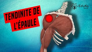 COMPRENDRE LA TENDINITE DE LÉPAULE Explications professionelles [upl. by Ahsinyd]