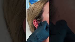 CONCH PIERCING [upl. by Bron]