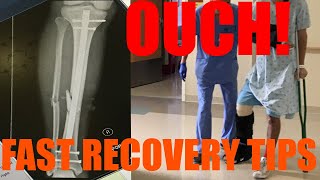 How to Recover Quickly From Broken Leg Fractured Tibia  Fibula ORIF Surgery [upl. by Nelleoj]