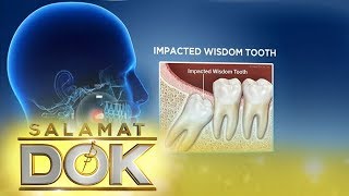 Salamat Dok Expert talks about wisdom tooth [upl. by Angelis152]