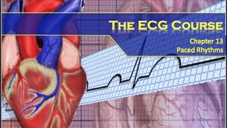 The ECG Course  Paced Rhythms [upl. by Sarad186]