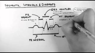 ECG 3  Segments Intervals amp Diseases [upl. by Artemisia]