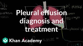 Pleural effusion diagnosis and treatment  Respiratory system diseases  NCLEXRN  Khan Academy [upl. by Allerym]