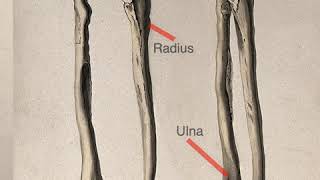 One Minute Anatomy A Difference Between the TibiaFibula amp RadiusUlna [upl. by Adyeren]