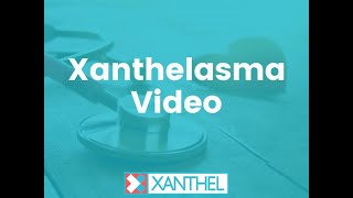 Xanthelasma How To Easily Remove Them With Xanthel ® Suprisingly Affordable [upl. by Bang]