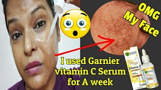 I Used NEW Garnier Vitamin C Serum For A Week See ResultGARNIER VITAMIN C SERUM REVIEWShinny Roops [upl. by Madalena]