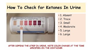 Urine Ketone Testing Technique [upl. by Neelear]