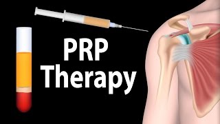 PRP Therapy Animation [upl. by Anivle]