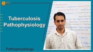 Tuberculosis Pathophysiology [upl. by Gredel13]