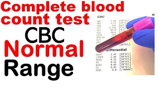 Complete blood count or CBC test normal range [upl. by Jocelyn255]