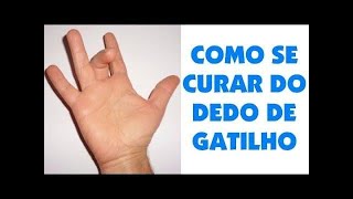 DEDO em GATILHO TENOSSINOVITE ESTENOSANTE CAUSAS amp TRATAMENTO Clínica Fisioterapia Dr Robson Sitta [upl. by Alahs]