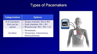 An Introduction to Pacemakers [upl. by Yelsnia]