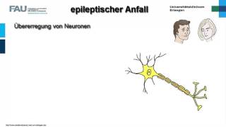 Neuropathologie ─ Epilepsie [upl. by Mcnally]