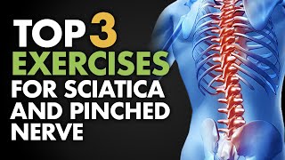 Top 3 Exercises for Sciatica and Pinched Nerve [upl. by Dowlen]