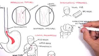 The Oesophagus Esophagus  Clinical Anatomy [upl. by Gunthar88]