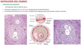 Topic 55 Ovarian Neoplasms [upl. by Faxan814]