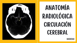 Anatomía Radiológica  Tomografía Computarizada Circulación cerebral [upl. by Blodget]