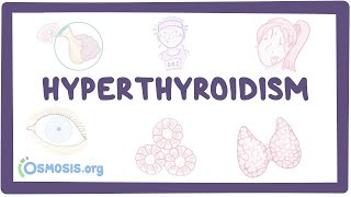 Hyperthyroidism  an Osmosis Preview [upl. by Ogires]