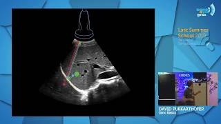 Sono Basics  Grundlagen der fokussierten Sonographie  David Purkarthofer  Late Summer School 2019 [upl. by Lehsreh]