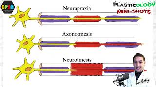 Plasticology  Nerve Injuries Classifications Tips amp Tricks [upl. by Hollerman]