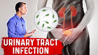 Top Natural Remedies for a UTI Urinary Tract Infection [upl. by Marcellina260]