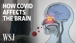 The Science Behind How the Coronavirus Affects the Brain  WSJ [upl. by Naillimxam]