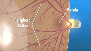 What is macular degeneration [upl. by Ennayr]