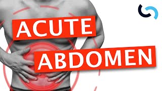 Acute Abdomen  Diagnosis and Management [upl. by Anderson565]