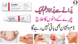 fucidin topical cream  fucidin cream  fucidin h cream uses in urdu  fucidin acid  how to use [upl. by Lokcin453]