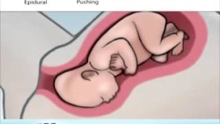 IUGR PREGNANCYBIRTH STORY [upl. by Jehovah]