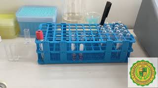 Glucose Measurment using Spectrophotometer [upl. by Acinnor]