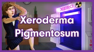 Xeroderma Pigmentosum Mnemonic for USMLE [upl. by Mw]