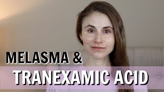 TRANEXAMIC ACID FOR MELASMA PILLS CREAMS INJECTIONS DR DRAY [upl. by Gilemette]