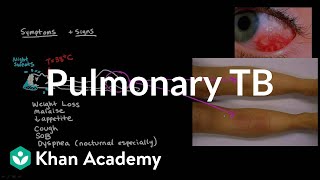 Pulmonary TB  Infectious diseases  NCLEXRN  Khan Academy [upl. by Erual34]