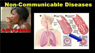 Noncommunicable Diseases [upl. by Nea]